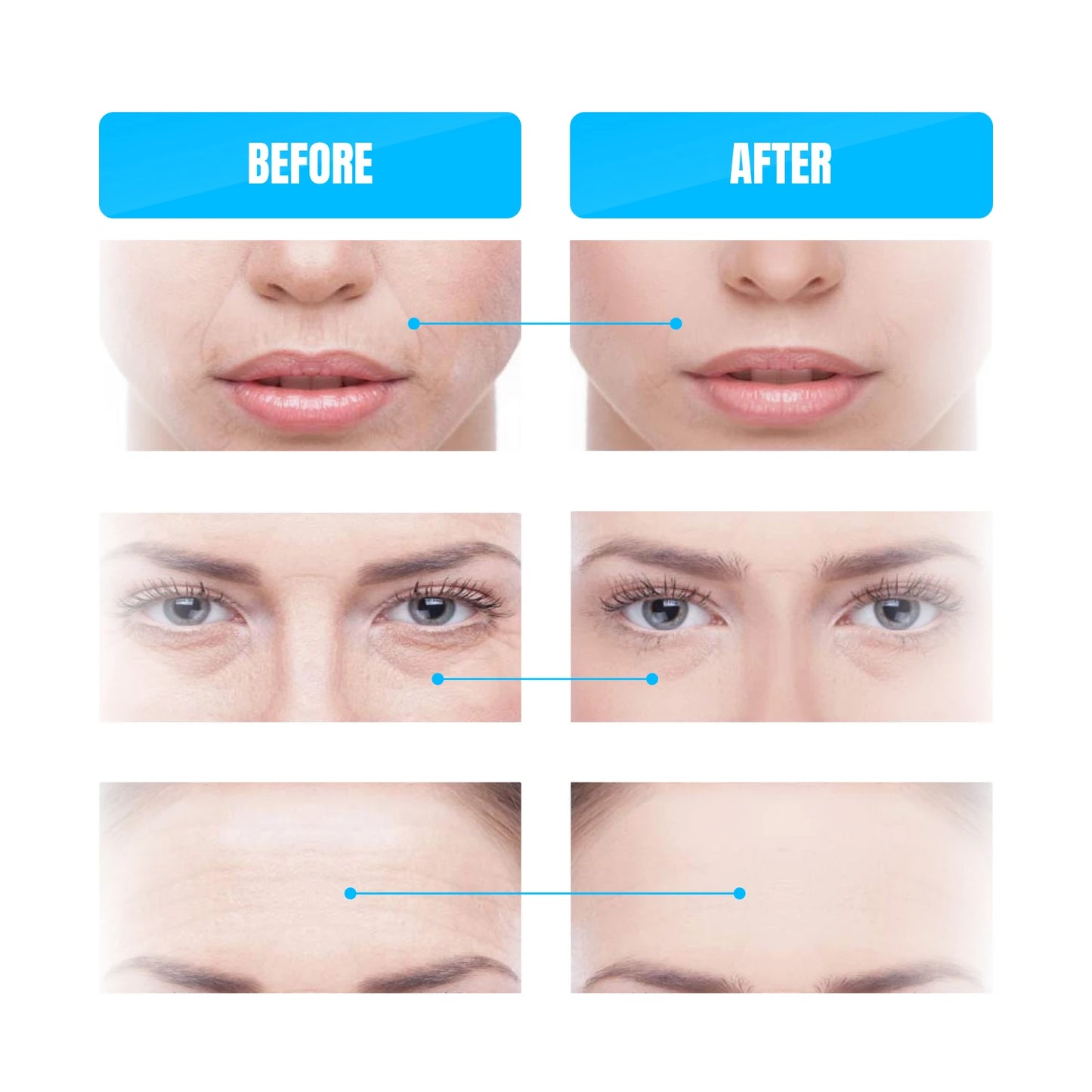 Microcurrent Facial Device